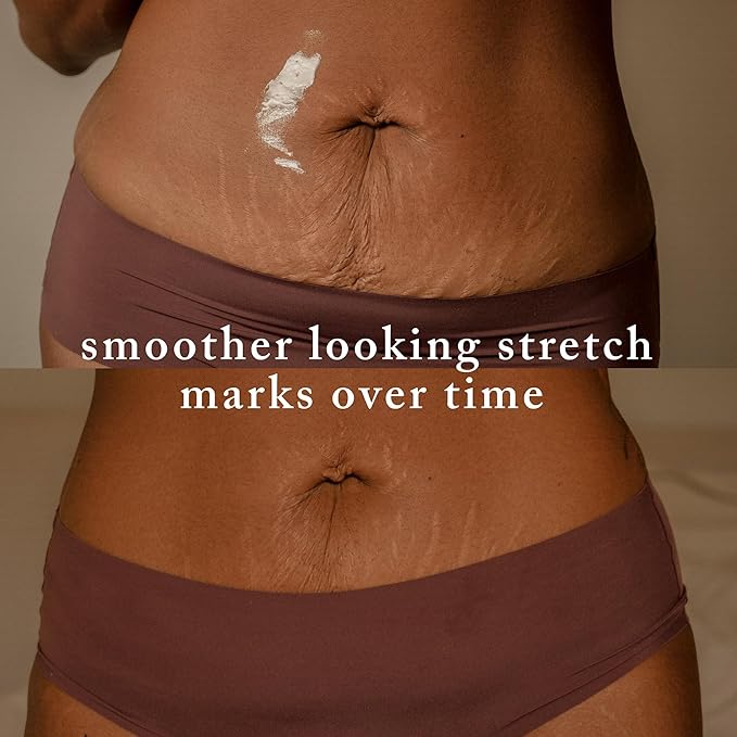 Nemah Stretch Mark Cream for Pregnancy, Moisturizing Belly Cream with Algaktiv UpLift, Shea Butter & Macadamia Oil, Pregnancy Body Cream for Belly, Hips & Thighs, 3.4 oz