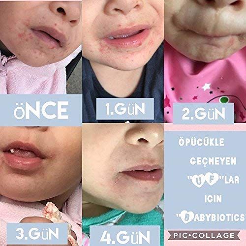 BabyBiotics - Topical Probiotic Body Care for Children of All Ages 4oz -Hypoallergenic, Vegan, Non GMO, GF, 100% Natural Live Probiotic, External + Internal Use, Totally Safe, No Refrigeration
