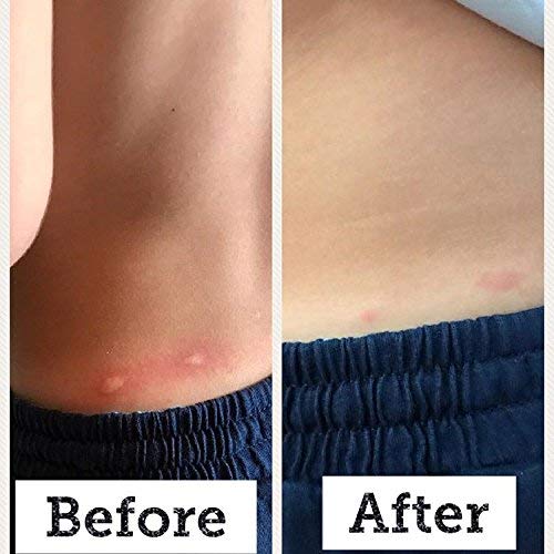 BabyBiotics - Topical Probiotic Body Care for Children of All Ages 4oz -Hypoallergenic, Vegan, Non GMO, GF, 100% Natural Live Probiotic, External + Internal Use, Totally Safe, No Refrigeration