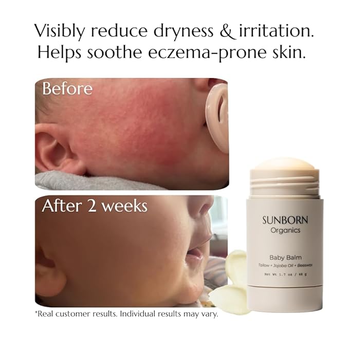Baby Balm | Baby-Safe Three Natural Ingredient Moisturizing Balm for Babies (Dry Skin, Diaper Rash & Eczema Relief) – Petroleum-Free, Fragrance/Essential Oil-Free, Third-party Lab-tested, All Natural