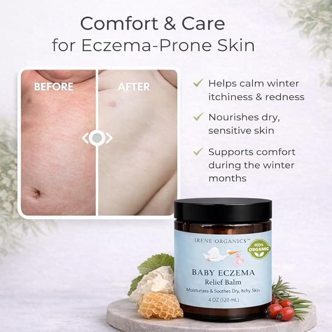 Irene Organics Baby Eczema Relief Balm, Healing Ointment Baby Moisturizing Cream for Eczema, Dry, Itchy Skin. Award Winning Baby Skincare for Sensitive Skin, Safe for Newborns, Kids and Adults