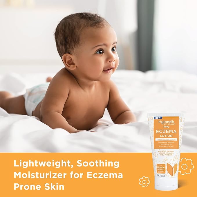 Hyland’s Baby Eczema Lotion, Lightweight Soothing Moisturizer for Eczema Prone Skin, With Colloidal Oatmeal, 5 ounce (Pack of 2)