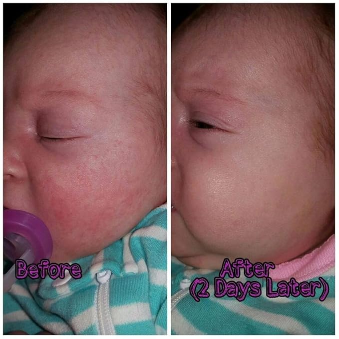 BabyBiotics - Topical Probiotic Body Care for Children of All Ages 4oz -Hypoallergenic, Vegan, Non GMO, GF, 100% Natural Live Probiotic, External + Internal Use, Totally Safe, No Refrigeration