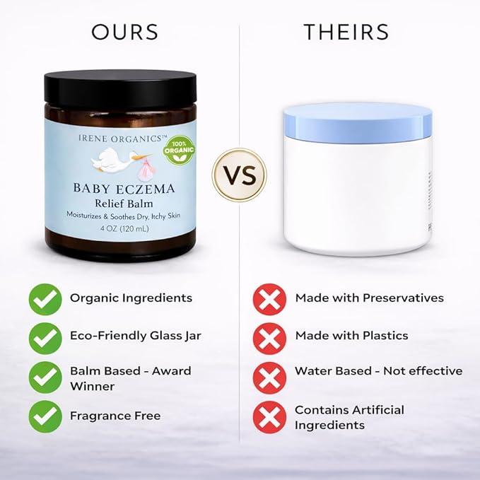Irene Organics Baby Eczema Relief Balm, Healing Ointment Baby Moisturizing Cream for Eczema, Dry, Itchy Skin. Award Winning Baby Skincare for Sensitive Skin, Safe for Newborns, Kids and Adults