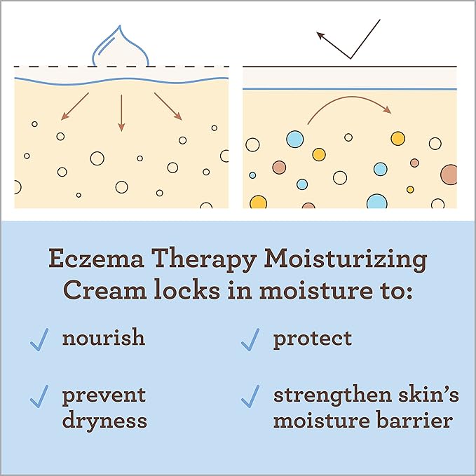 Aveeno Baby Eczema Therapy Moisturizing Cream, Natural Colloidal Oatmeal & Vitamin B5, Baby Cream for Dry, Itchy, Irritated Skin Due to Eczema, Paraben- & Steroid-Free, 5 fl. oz
