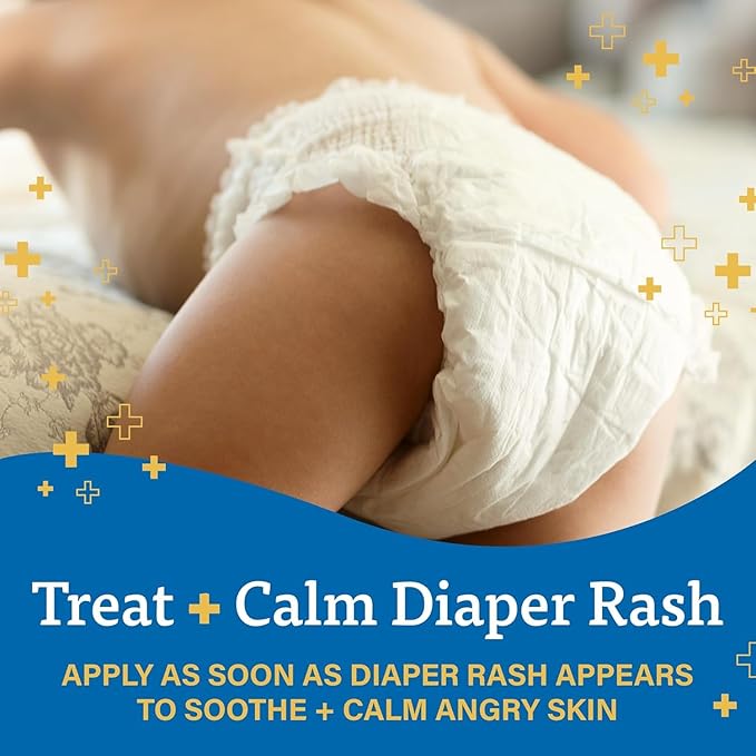 A+D Diaper Rash Cream, Dimethicone Zinc Oxide Cream, 4 oz (113 g) (Pack of 1) Size: Pack of 1, Model:, Baby & Child Shop