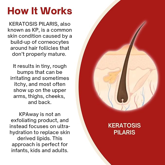 Moisturizing Keratosis Pilaris Cream for Kids | Gentle Hydration for Dry, Bumpy Skin | Dermatologist-Developed Lotion | Non-Irritating, Acid-Free Formula | 16 oz