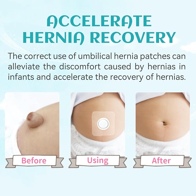 Baby Belly Navel Patches(15 Pieces), Hernia Patch,Belly Button Shaper with Waterproof Cotton Pads,Umbilical Hernia Belt Baby,Baby Belly Button wrap 8×8cm