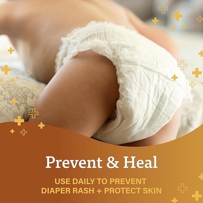 A+D Original Diaper Rash Ointment + Zinc Oxide Diaper Rash Cream 4oz Variety Pack - Prevents & Treats - Moisturizing Skin Protectant With Vitamins A & D