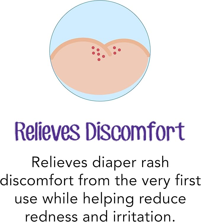 Desitin Daily Defense Baby Diaper Rash Cream with Zinc Oxide to Treat, Relieve & Prevent diaper rash, Hypoallergenic, Dye-, Phthalate- & Paraben-Free, 4 oz