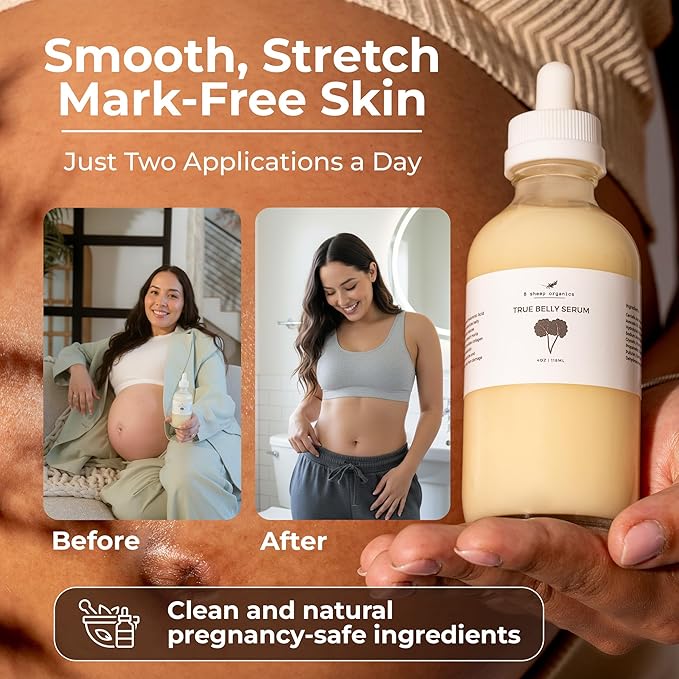 8 Sheep True Belly Serum, Pregnancy-Safe Skin Care Belly Oil with Triple-Weighted Hyaluronic Acid & Centella Asiatica, Supports Hydration & Skin Elasticity, Made in USA in Small Batches, 4 FL OZ
