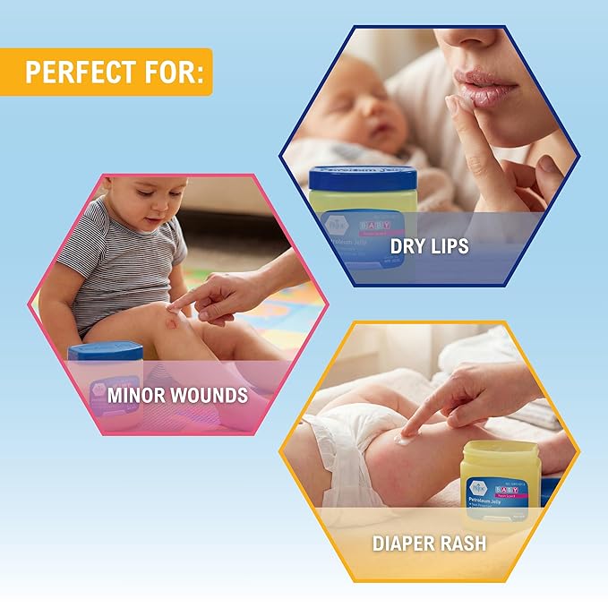 MED PRIDE Petroleum Jelly with Fresh Baby Scent, Baby Blue, 13 oz – Skin Protectant & Moisturizer for Dry Skin, Rashes, Minor Burns, Wounds, Chapped Lips, Dry Hands & Diaper Rash