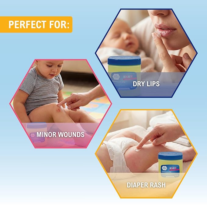 MED PRIDE Petroleum Jelly with Fresh Baby Scent, Baby Blue, 8 oz – Skin Protectant & Moisturizer for Dry Skin, Rashes, Minor Burns, Wounds, Chapped Lips, Dry Hands & Diaper Rash