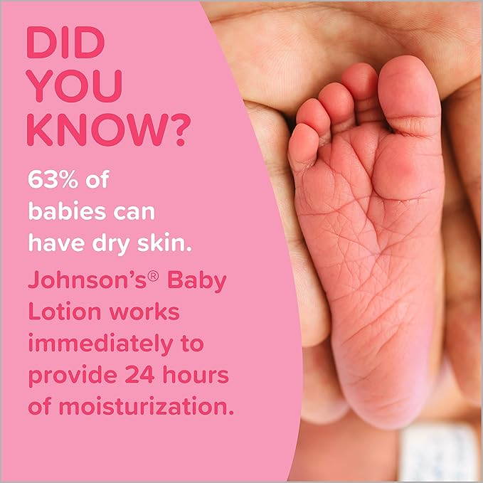 Johnson's Moisturizing Mild Pink Baby Lotion with Coconut Oil for Delicate Baby Skin, Paraben-, Phthalate- & Dye-Free, Hypoallergenic & Dermatologist-Tested, Baby Skin Care, 3.4 Fl. Oz (Pack of 3)